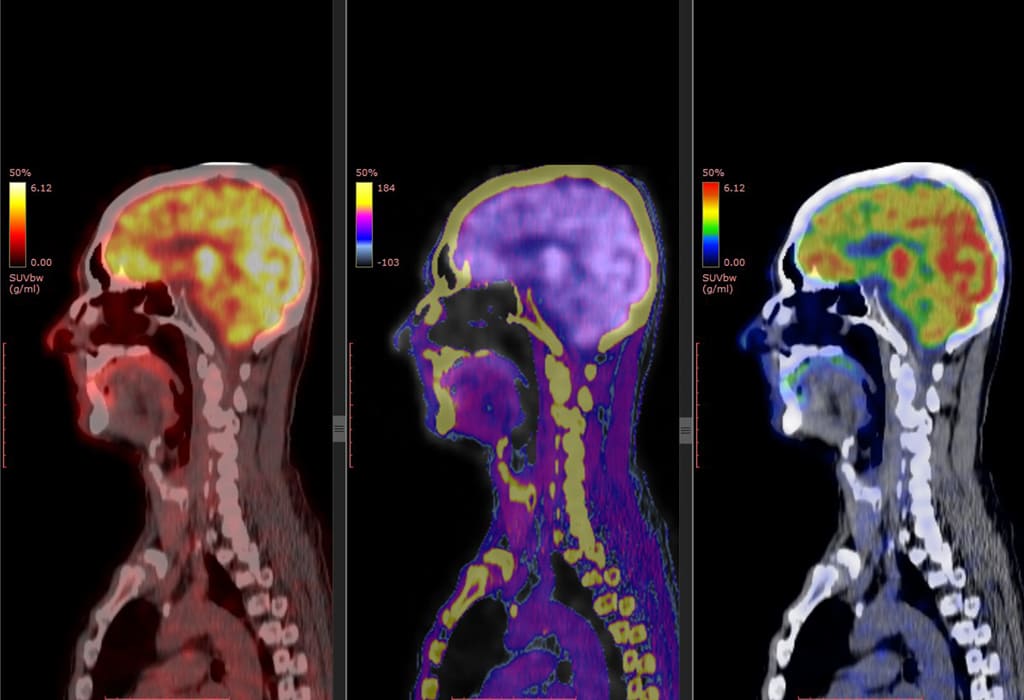 Diagnostic/Imaging Studies Atlanta Neurology